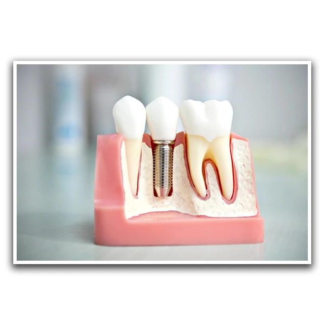 تابلو بکلیت طرح دندانپزشکی مدل W-D1163