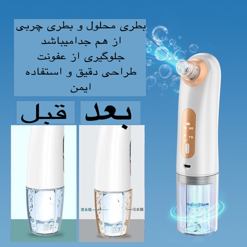 میکرودرم خانگی مدل X17 میکرودرم خانگی مدل X17