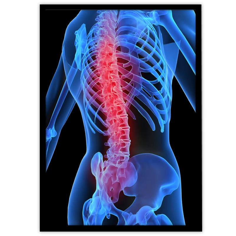 تابلو نوری بکلیت طرح رادیوگرافی و رادیولوژی مدل B-8679