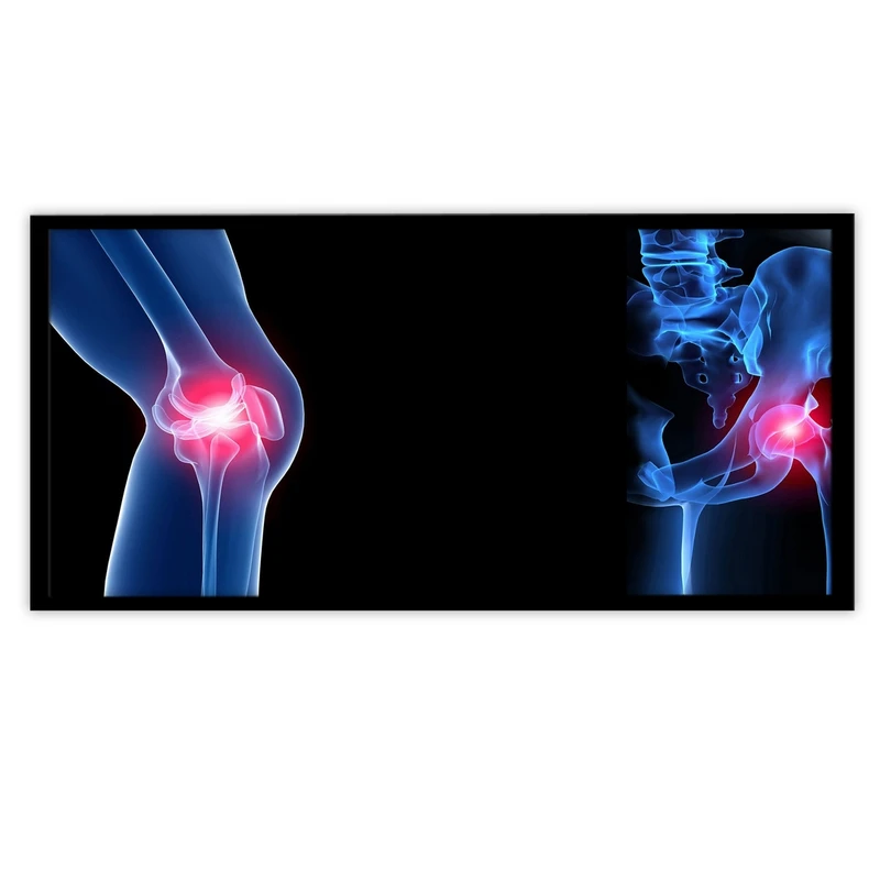 تابلو بکلیت طرح رادیوگرافی مفصل زانو مدل B-10621