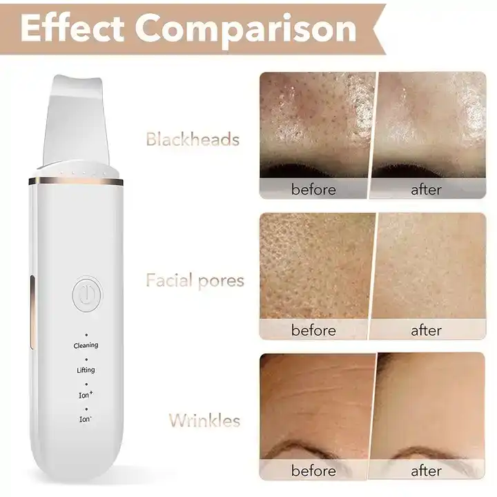 اتو صورت اولتراسونیک مدل 7C-CPY01