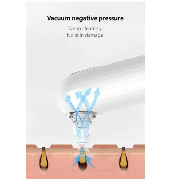 میکرودرم استس بیوتی مدل GB-4706