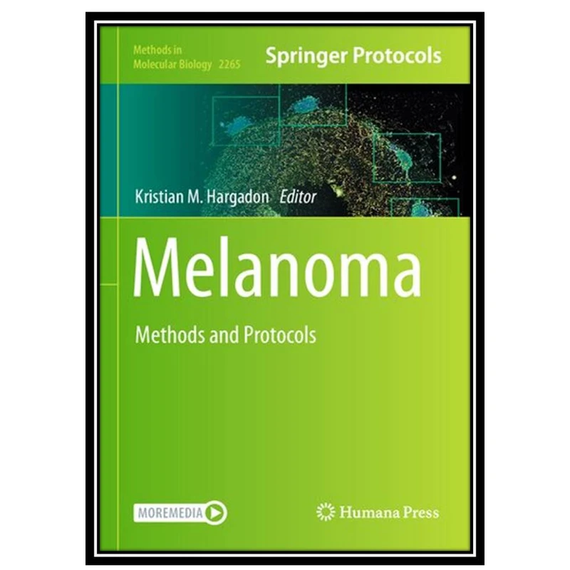 کتاب Melanoma: Methods and Protocols اثر Kristian M. Hargadon انتشارات مؤلفین طلایی
