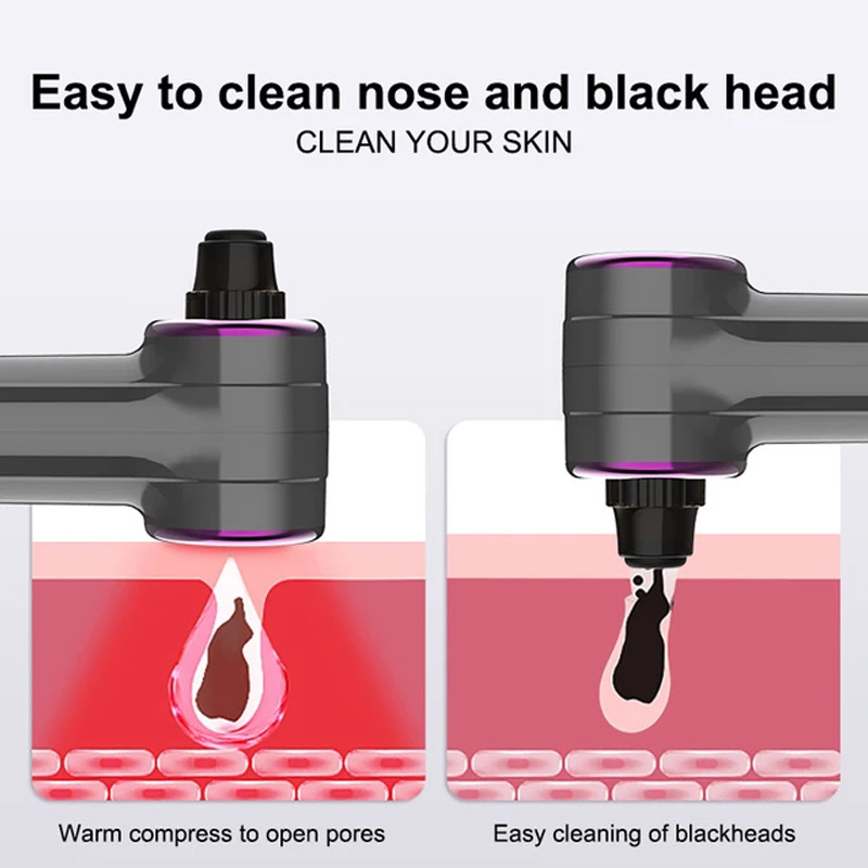 میکرودرم خانگی مدل S2