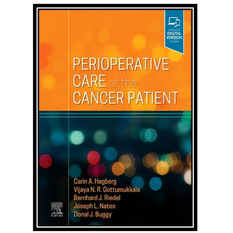 کتاب Perioperative Care of the Cancer Patient اثر جمعی ازنویسندگان انتشارات مؤلفین طلایی