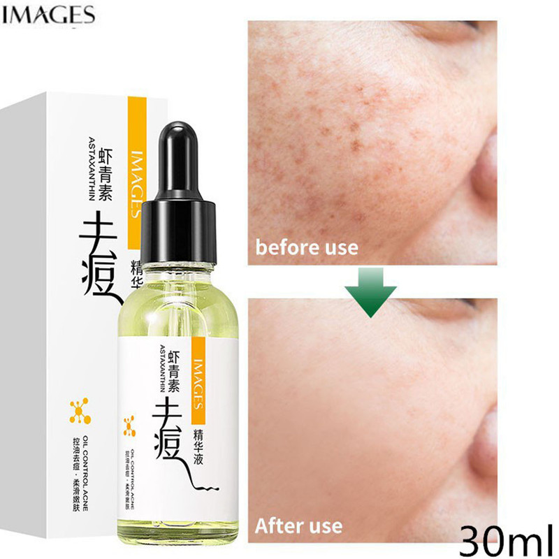 سرم ضد جوش ایمجز مدل ASTAXANTHIN حجم 30 میلی لیتر