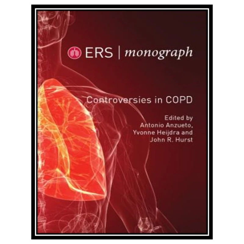 کتاب Controversies in COPD اثر جمعی از نویسندگان انتشارات مؤلفین طلایی