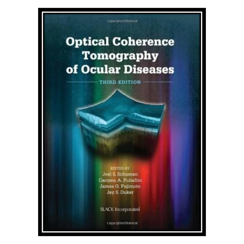 کتاب Optical Coherence Tomography of Ocular Diseases اثر جمعی از نویسندگان انتشارات مؤلفین طلایی