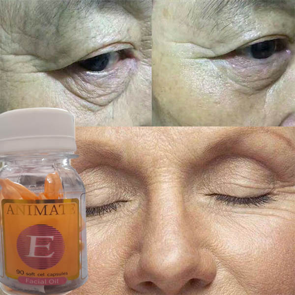 کپسول ضد چروک صورت و دور چشم انیمیت مدل ویتامین E حجم 10 میلی لیتر مجموعه 10 عددی
