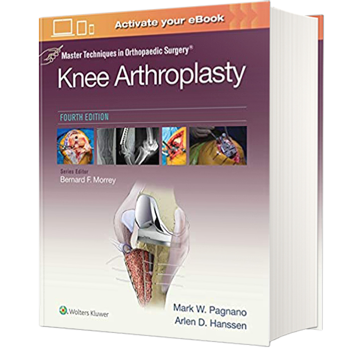 کتاب Master Techniques in Orthopedic Surgery Knee Arthroplasty اثر Mark W. Pagnano and Arien D.Hanssen انتشارات لیپین کات