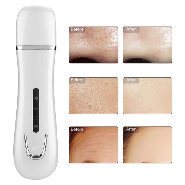 دستگاه پاکسازی پوست مدل JZC-C001
