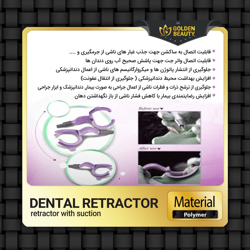 دهان بازکن دندانپزشکی گلدن بیوتی مدل RC کد 01 بسته یک عددی