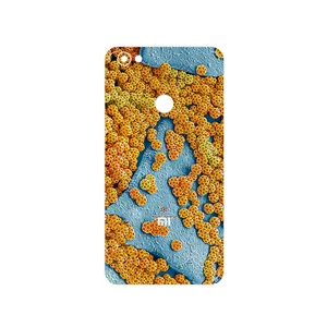 MAHOOT Atom Universe 7 Cover Sticker for Xiaomi Redmi Note 5A Prime