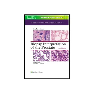کتاب Biopsy Interpretation of the Prostate اثر Jonathan I. Epstein انتشارات لیپین کات