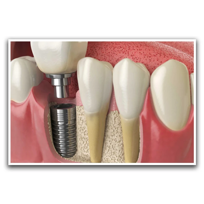 تابلو نوری بکلیت طرح دندان و دندانپزشکی مدل W-D1250