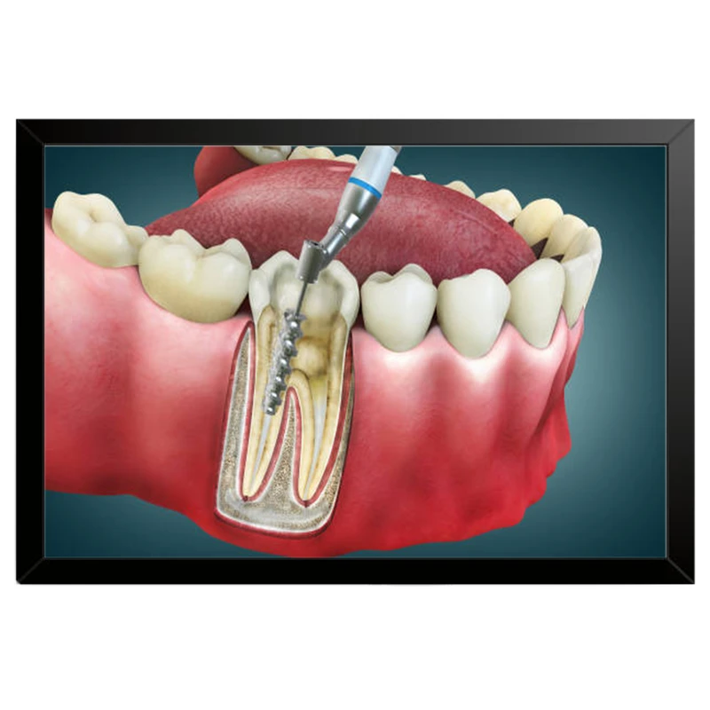 تابلو بکلیت طرح سلامت دندان و مطب دندانپزشکی مدل B-pe130143 فریم مشکی