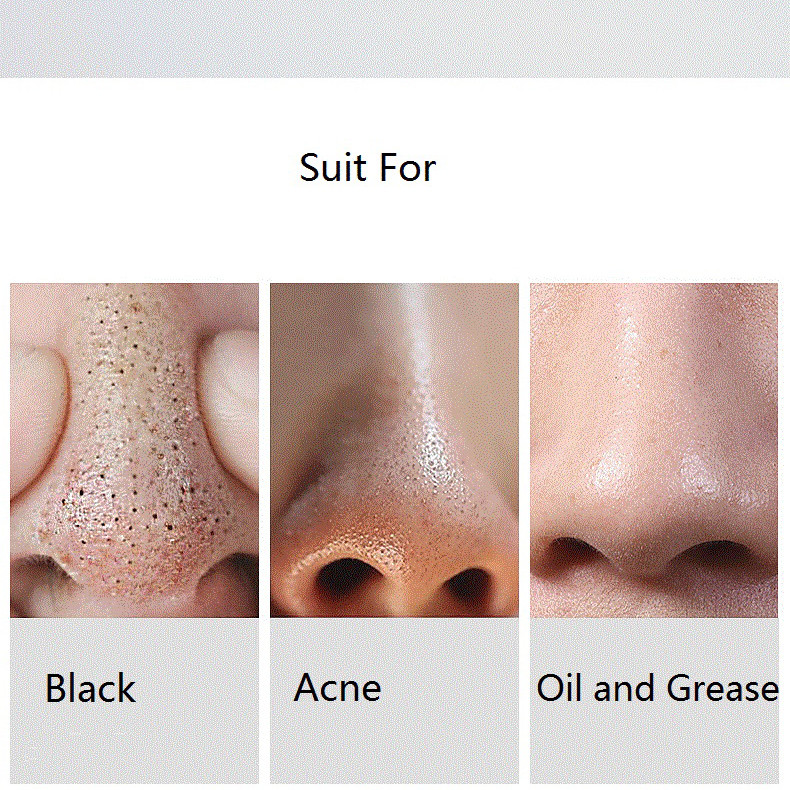 میکرودرم خانگی مدل MP503