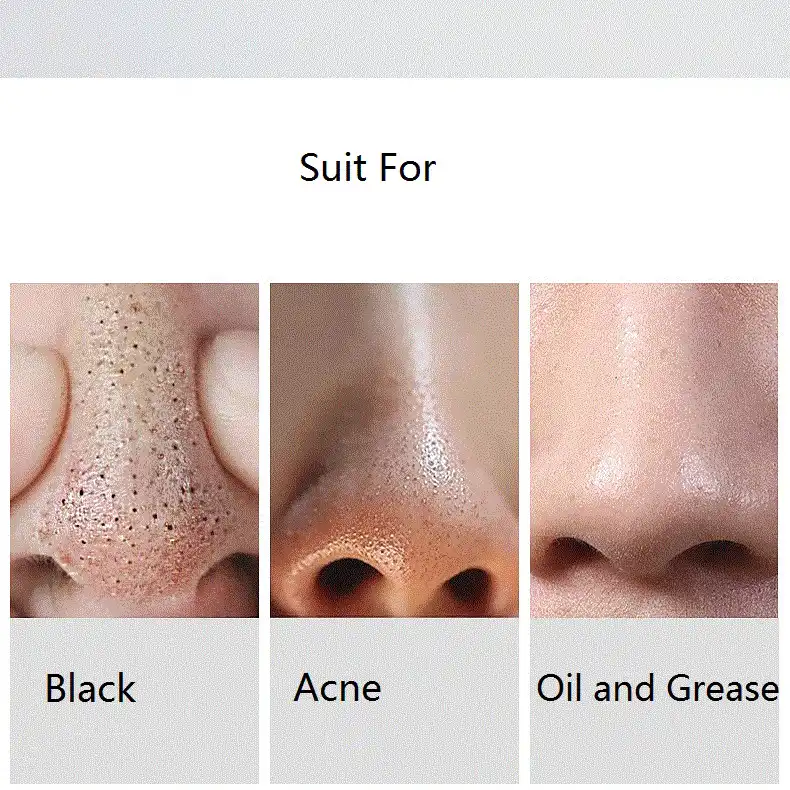 میکرودرم خانگی مدل MP503