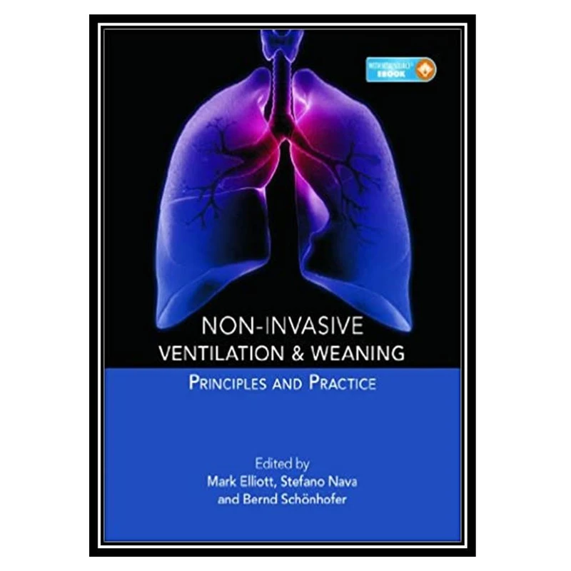 کتاب Non-invasive ventilation and weaning : principles and practice اثر جمعی از نویسندگان انتشارات مؤلفین طلایی