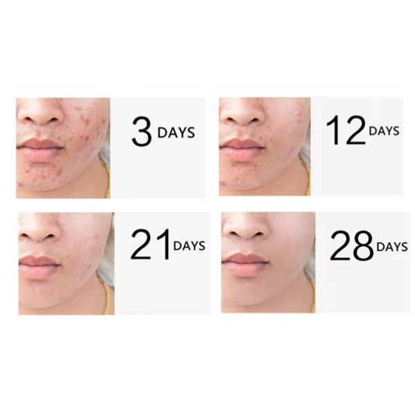 سرم پوست ياكساي مدل A1 حجم 60 میلي لیتر بسته 44 عددي