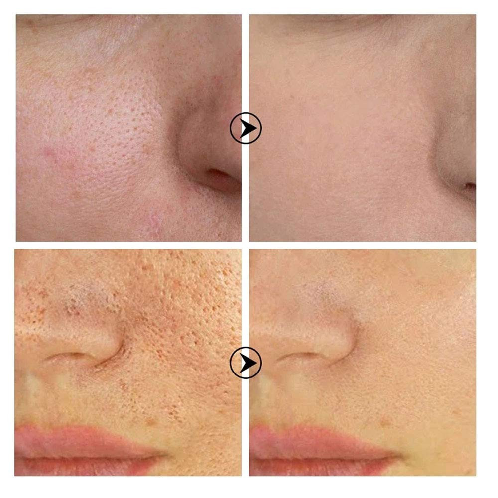 سرم پوست لنبنا مدل Pore Treatment حجم 15 میلی لیتر سرم پوست لنبنا مدل Pore Treatment حجم 15 میلی لیتر