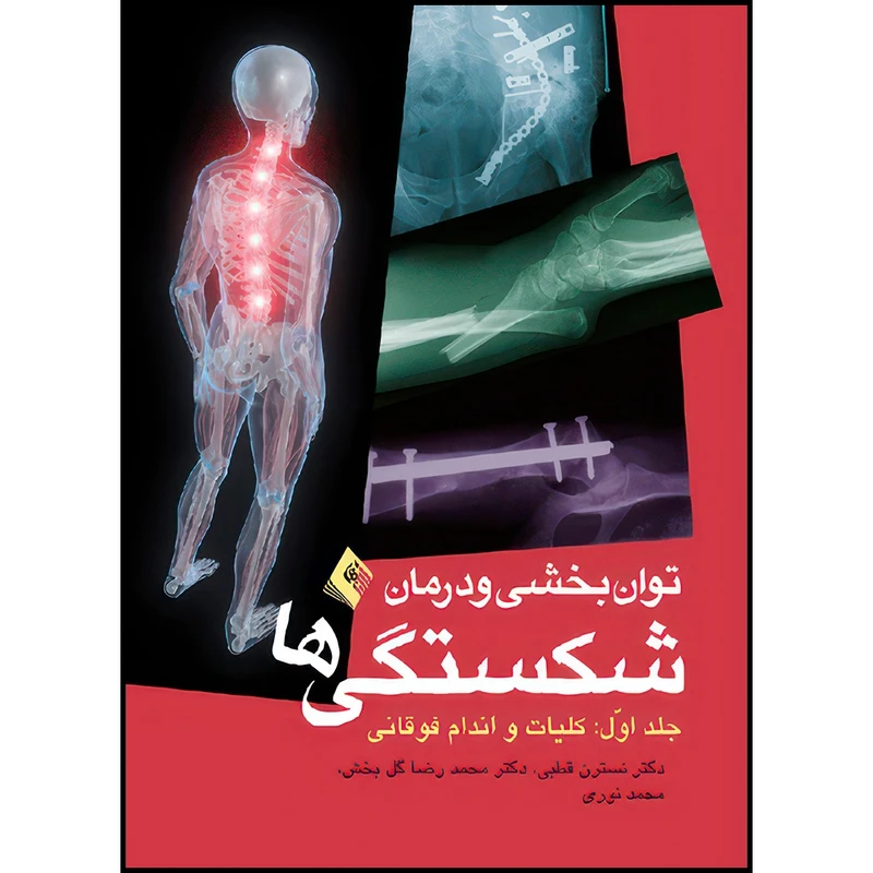 کتاب توانبخشی و درمان شکستگیها: کلیات، اندام فوقانی (جلد 1) اثر دکتر نسترن قطبی و دکتر محمدرضا گلبخش و محمد نوری انتشارات ارجمند
