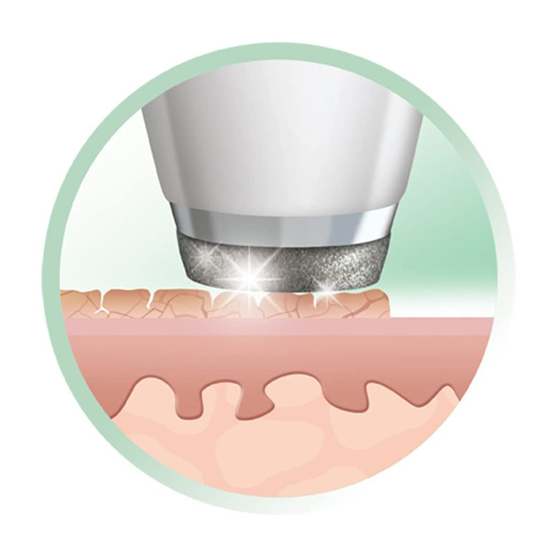 میکرودرم رمینگتون مدل REVEAL DIAMOND MD3000 میکرودرم رمینگتون مدل REVEAL DIAMOND MD3000