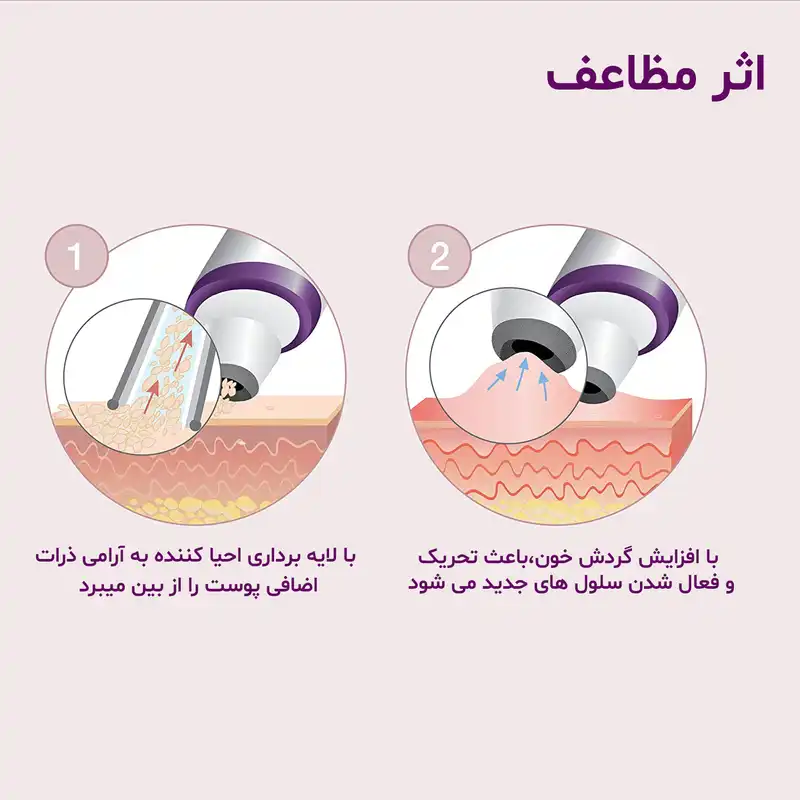 میکرودرم بیورر مدل FC 76