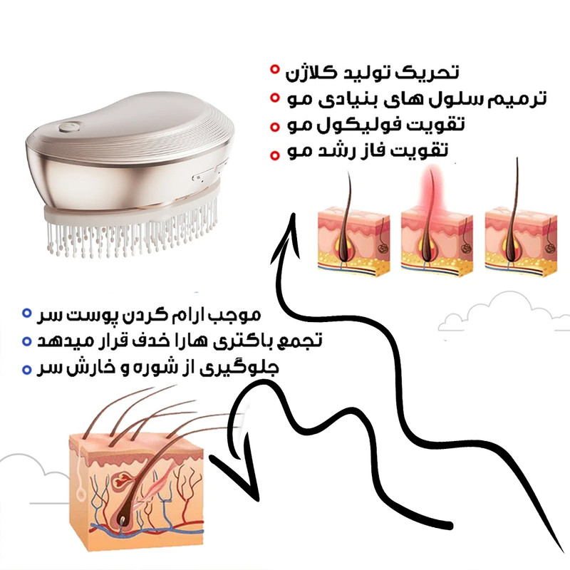 ماساژور برقی سر مدل محرک رشد مو کد MZG-24