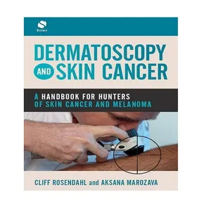 کتاب Dermatoscopy and Skin Cancer اثر  Cliff Rosendahl And  Aksana Marozava انتشارات SCION