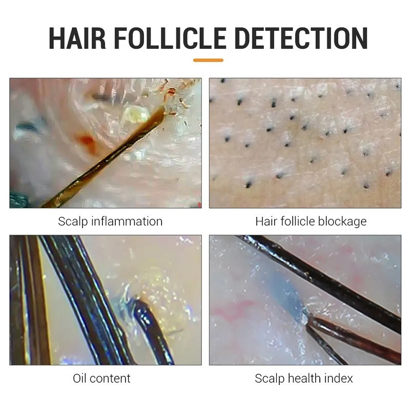 دستگاه آنالیز پوست و مو مدل BD-701