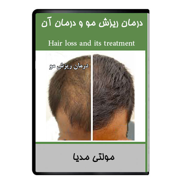 نرم افزار درمان ریزش مو و درمان آن نشر هرسه