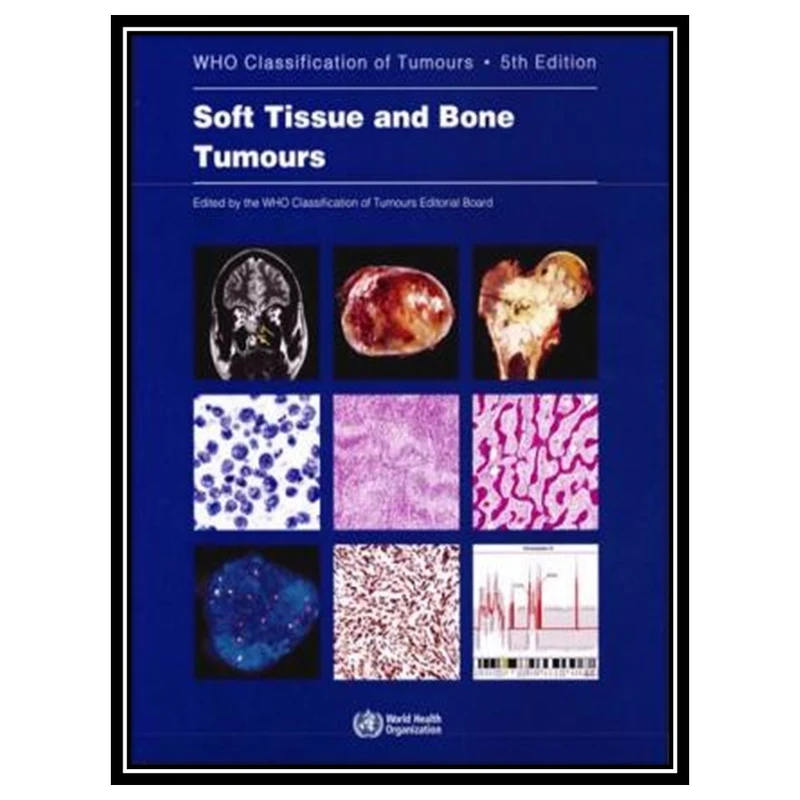 کتاب Soft Tissue and Bone Tumours: WHO Classification of Tumours (Medicine) اثر WHO Classification of Tumours Editorial Board انتشارات مؤلفین طلایی