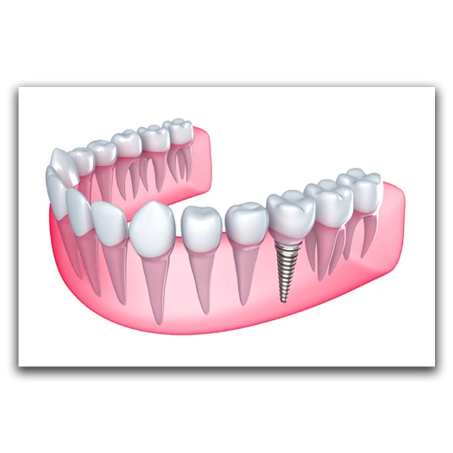 تابلو بکلیت طرح دندانپزشکی مدل W-D1175