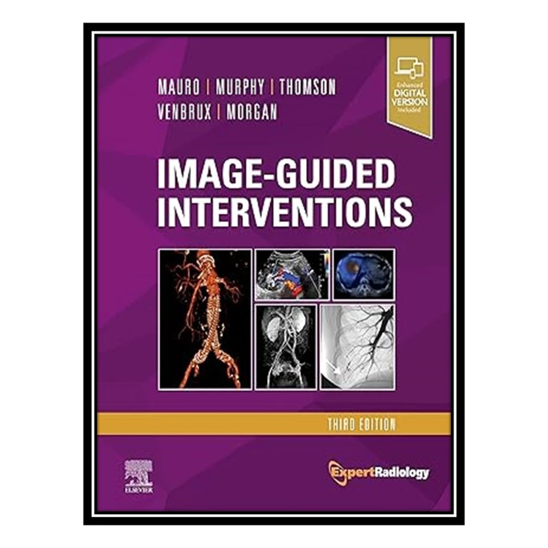 کتاب Image-Guided Interventions اثر جمعی از نویسندگان انتشارات مؤلفین طلایی
