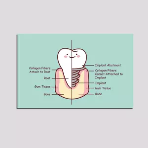 تابلو مدل دندان و دندانپزشکی کد 332
