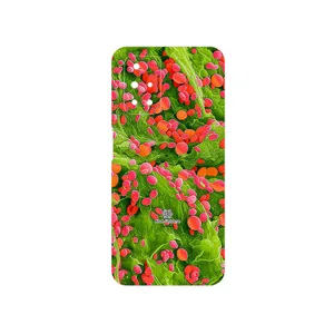 MAHOOT Atom Universe 3 Cover Sticker for Xiaomi Redmi 10