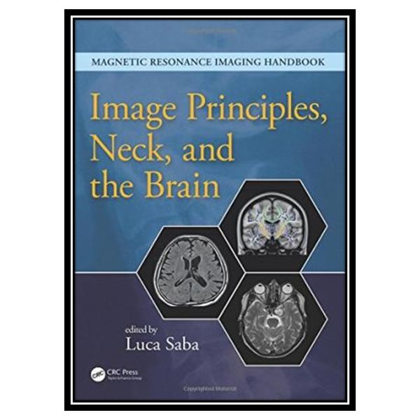 کتاب Image Principles Neck and the Brain اثر Luca Saba انتشارات مؤلفین طلایی کتاب Image Principles Neck and the Brain اثر Luca Saba انتشارات مؤلفین طلایی