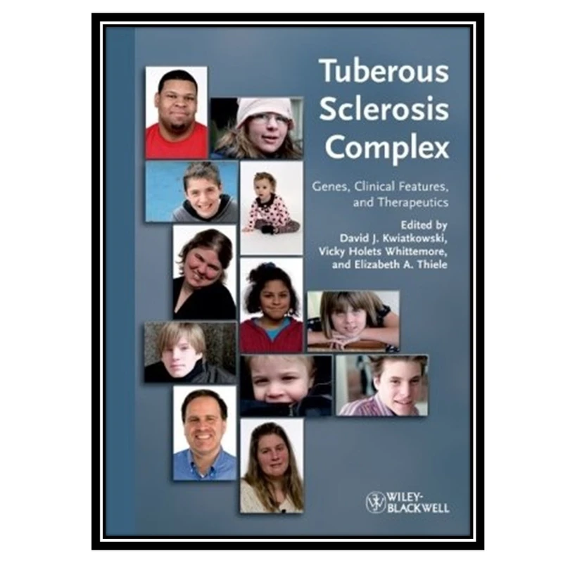 کتاب Tuberous Sclerosis Complex: Genes, Clinical Features and Therapeutics اثر جمعی از نویسندگان انتشارات مؤلفین طلایی