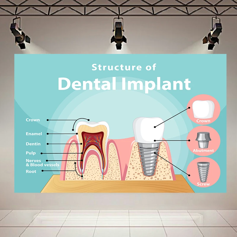 کاغذ دیواری مدل ساختار ایمپلنت دندان کد AR305597