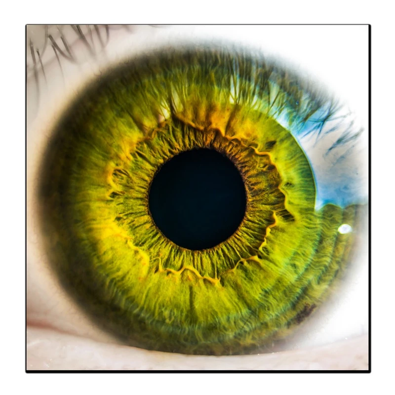 تابلو شاسی بکلیت طرح چشم پزشکی مدل SH-12468