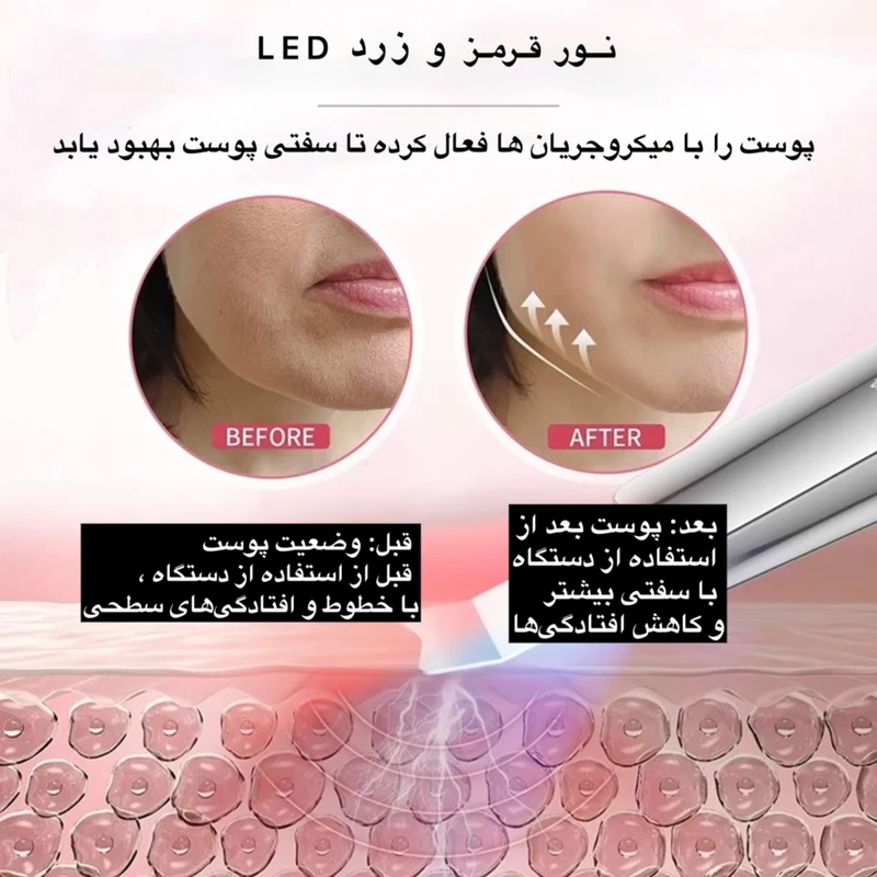 عکس شماره 14 : اتو جوانساز صورت مدل c-118