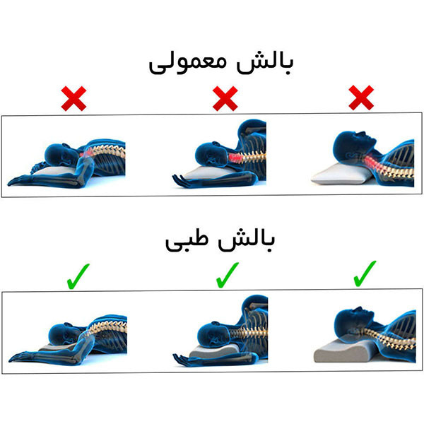 بالش طبی های-تک مدل  MF100L