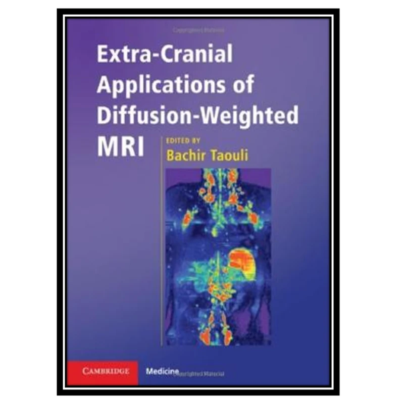 کتاب Extra-Cranial Applications of Diffusion-Weighted MRI اثر Bachir Taouli انتشارات مؤلفین طلایی