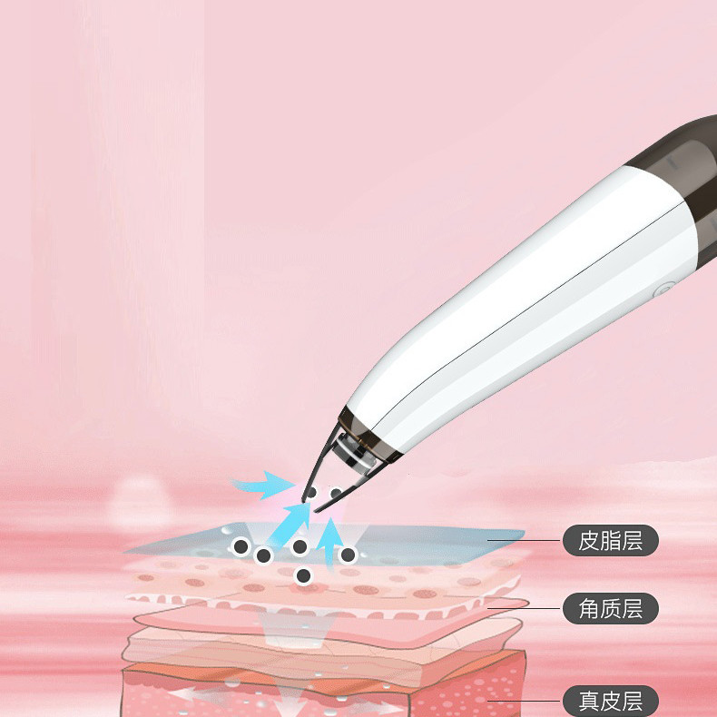 میکرودرم خانگی مدل MP503