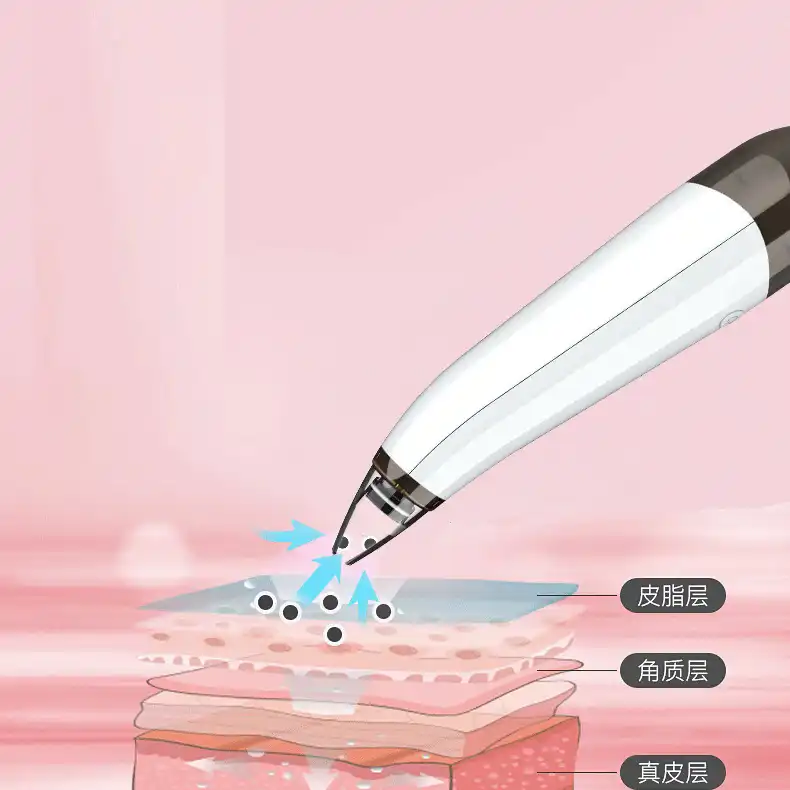 میکرودرم خانگی مدل MP503