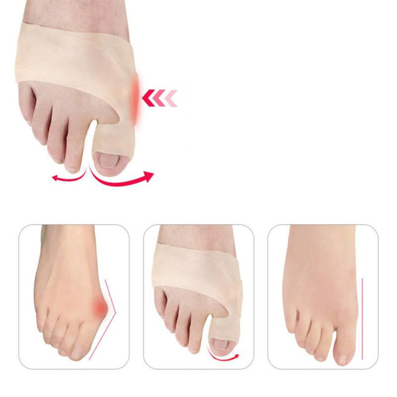 پد هالوکس والگوس دکتر فوت مدل A020 بسته 2 عددی