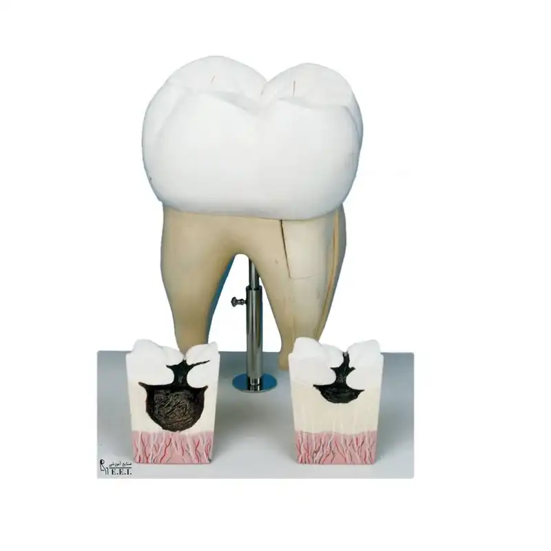 بازی آموزشی مدل مولاژ اولین دندان آسیاب فک تحتانی