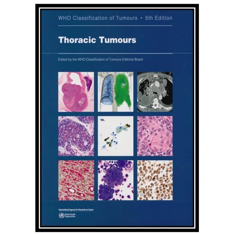 کتاب Thoracic Tumours: WHO Classification of Tumours اثر WHO Classification of Tumours Editorial Board انتشارات مؤلفین طلایی