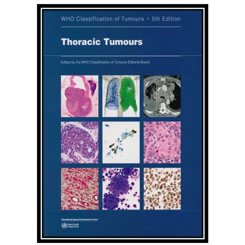 کتاب Thoracic Tumours: WHO Classification of Tumours اثر WHO Classification of Tumours Editorial Board انتشارات مؤلفین طلایی